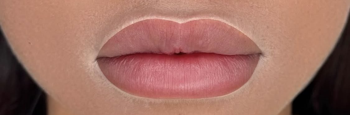 Usta po zabiegu Natural Lips